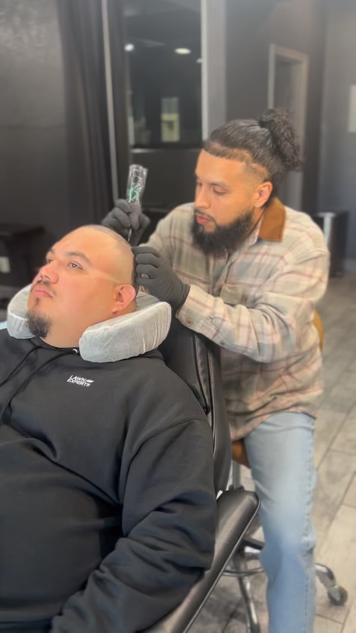 Side view of scalp micro pigmentation work in progress